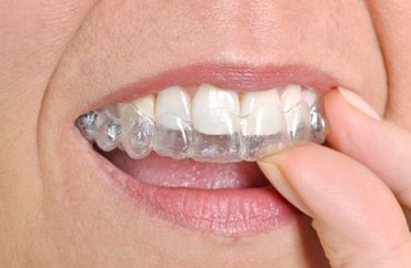 Invisalign® in London Ontario - Cosmo Dental Centre