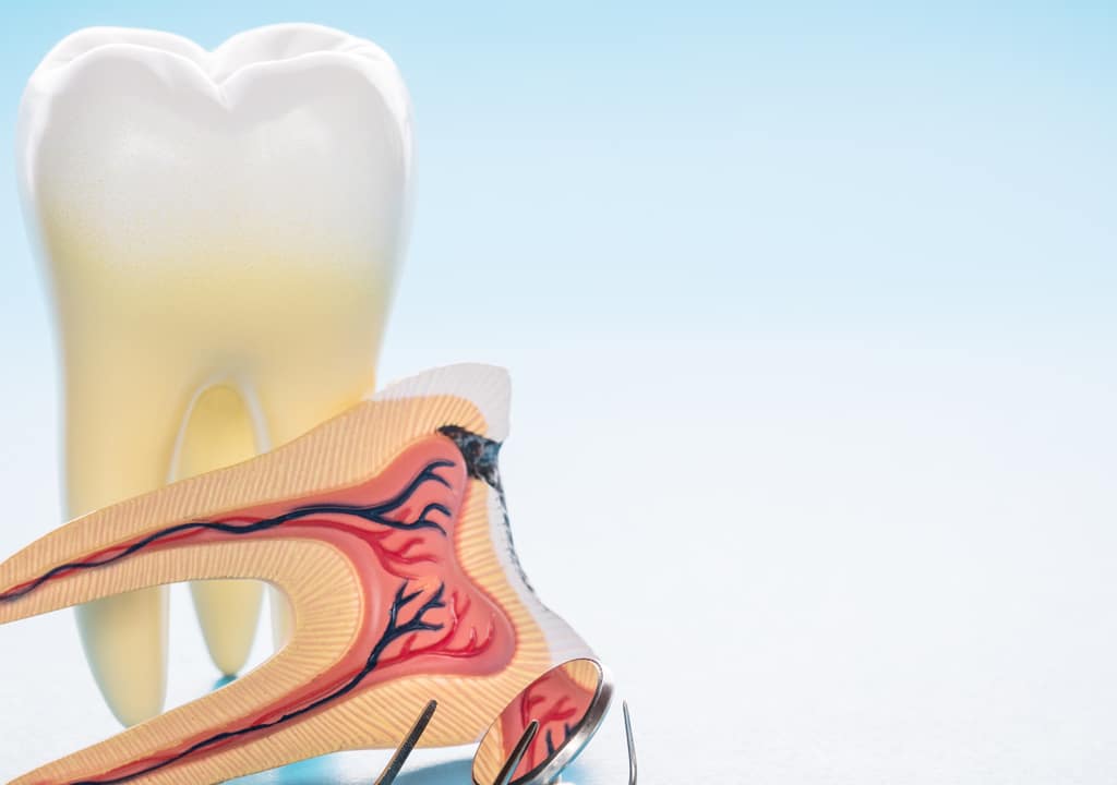 Representation of root canal with instrument