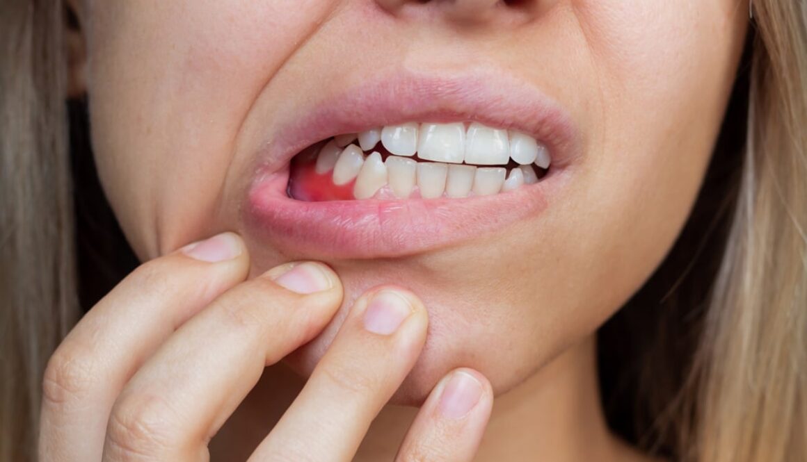 Why are my gums bleeding-Apple-Dental-Tree