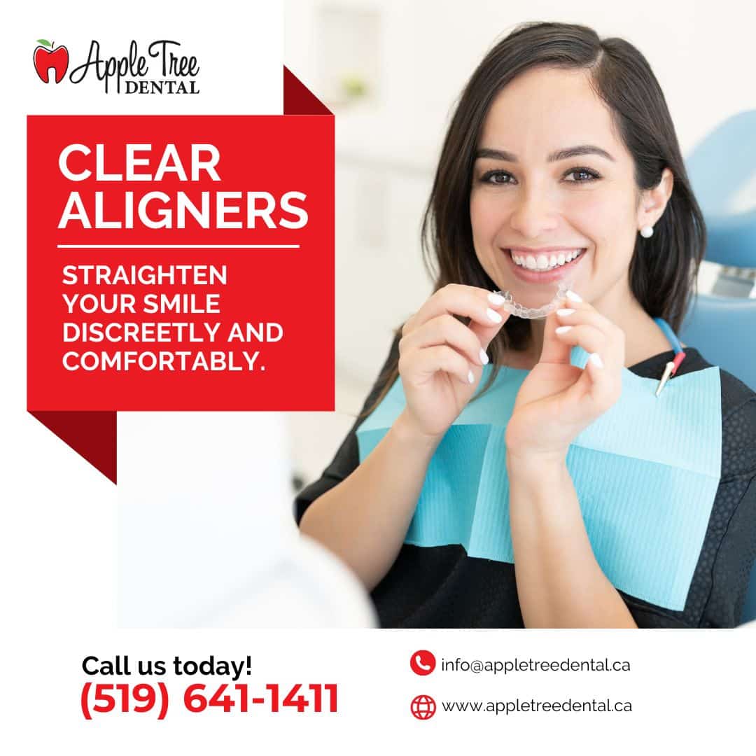 Clear Aligners By Apple Tree Dental