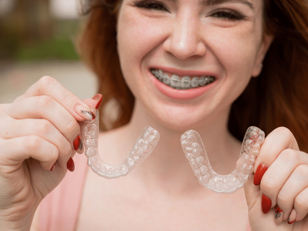 Top 5 Reasons to Choose Clear Aligners Over Traditional Braces in London, Ontario