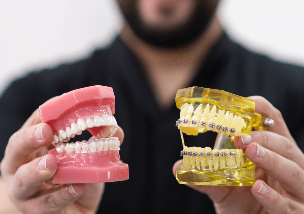 Clear Aligners vs. Braces: Choosing the Right Smile Solution in London, Ontario