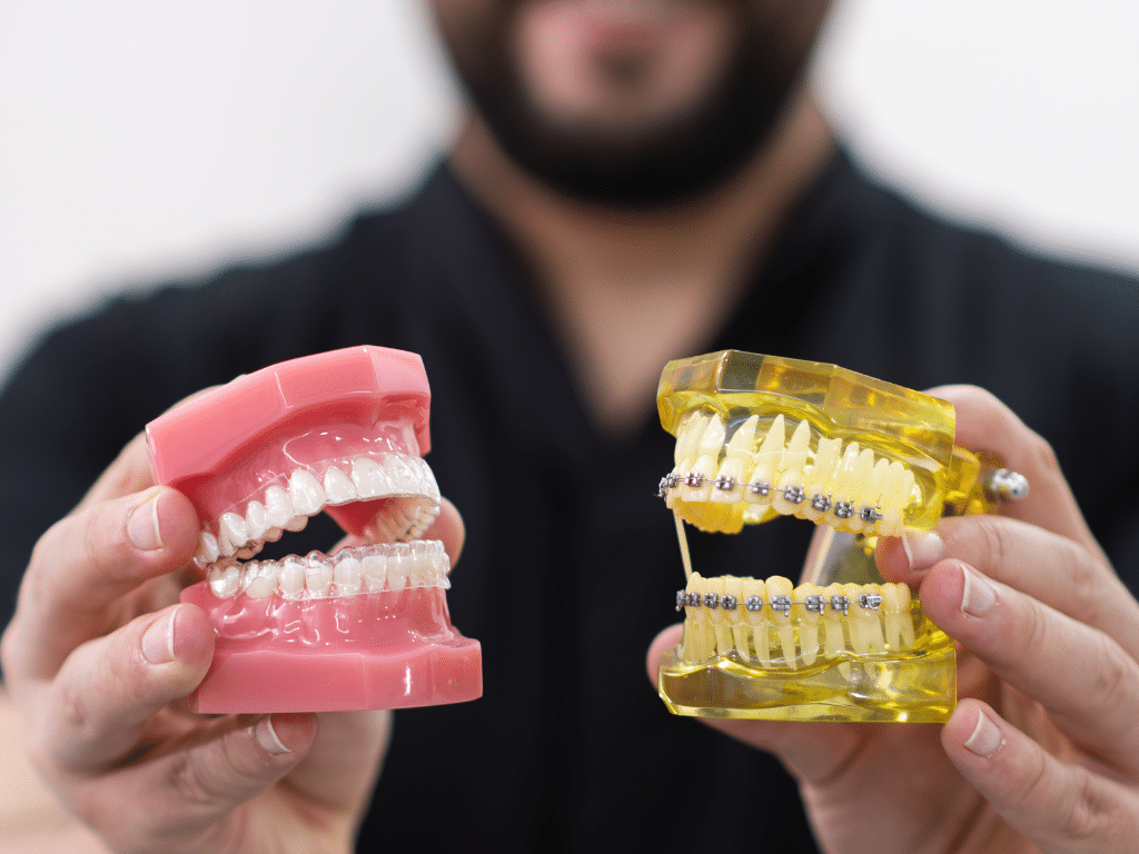 Unveiling Your Perfect Smile Clear Aligners vs. Braces in London, Ontario
