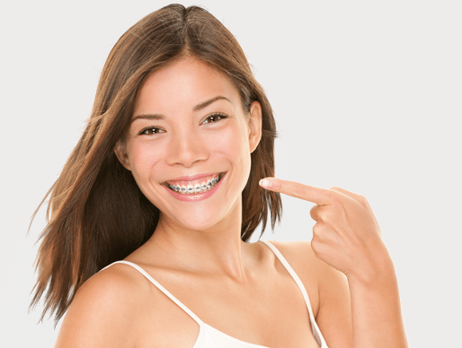 Girl smiling with Fastbraces