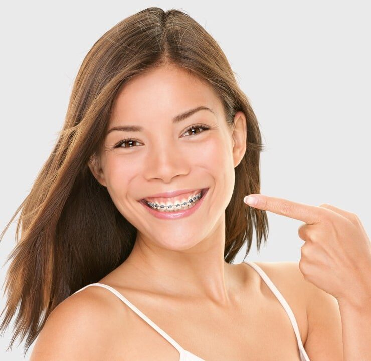 Girl is pointing towards her braces
