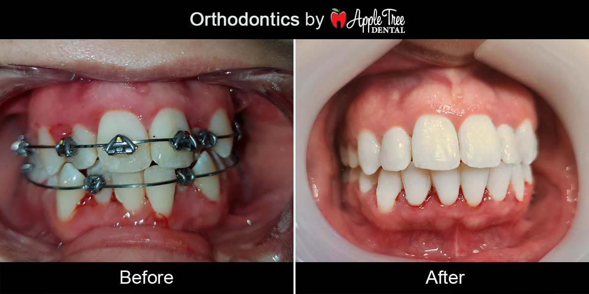 Orthodontics-1