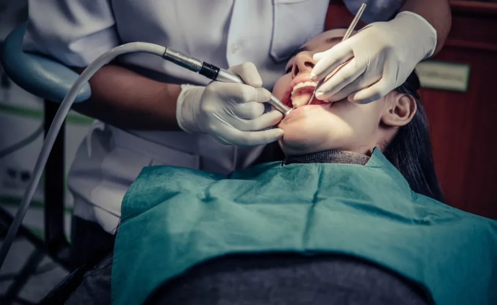 wisdom tooth extraction London
