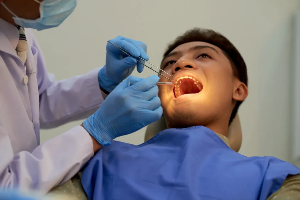 wisdom tooth extraction London