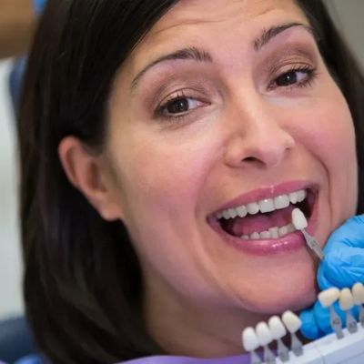 dental bridges and crowns