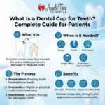 Dental Cap for Teeth
