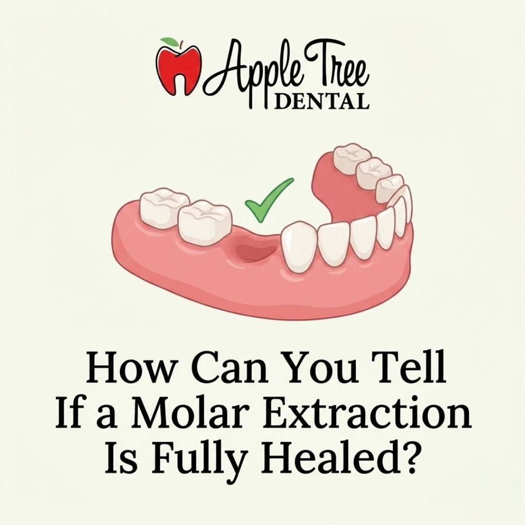 healed molar extraction