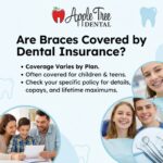 Are Braces Covered by Dental Insurance?