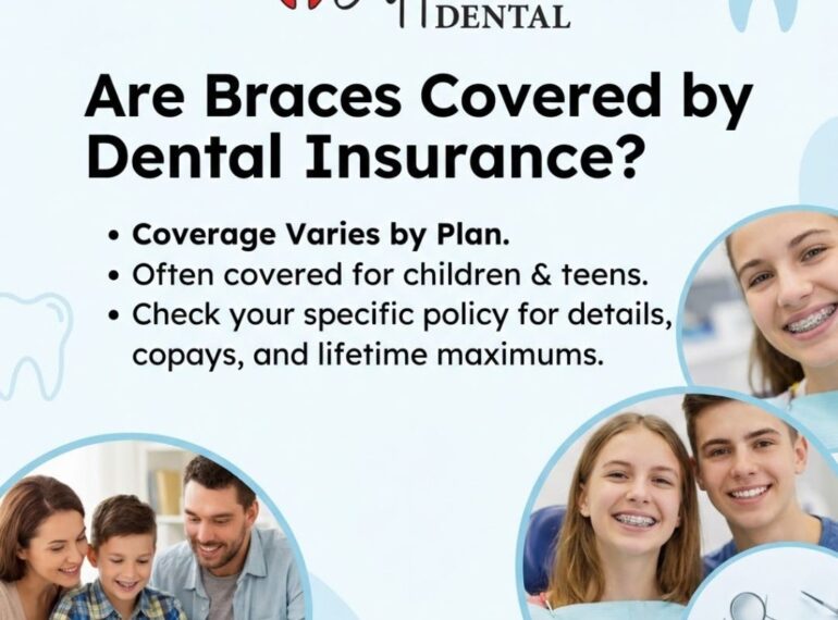 Are Braces Covered by Dental Insurance?
