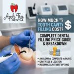 tooth cavity filling cost
