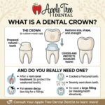 what is a dental crown