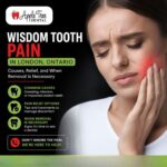 Wisdom Tooth Pain in London