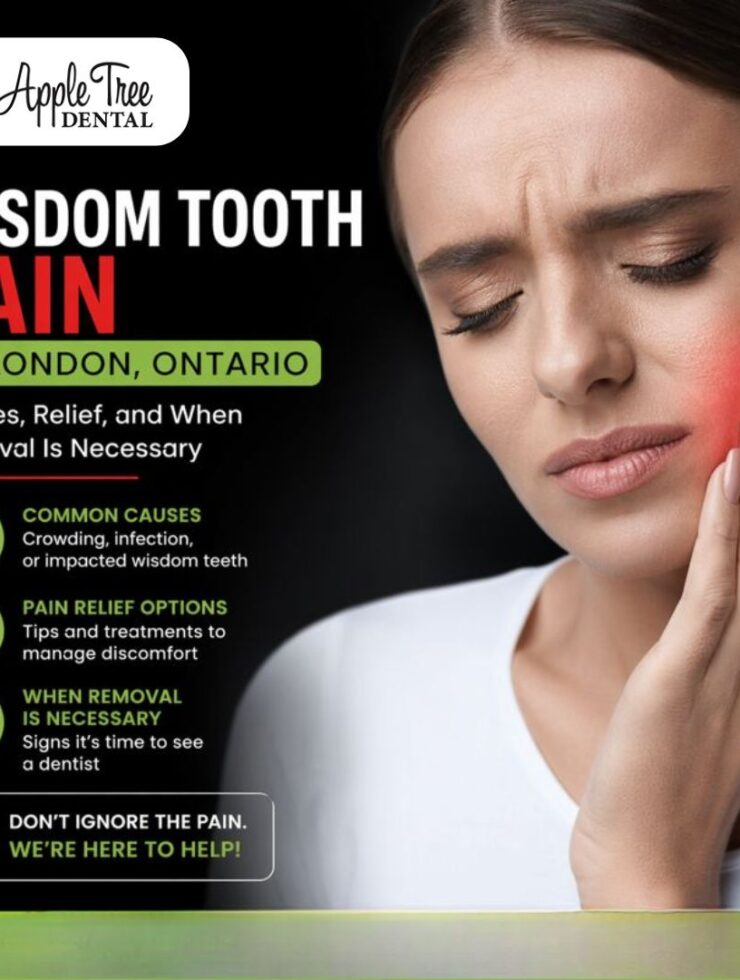 Wisdom Tooth Pain in London