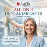 all on 4 dental implants