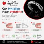 Can Invisalign Fix an Underbite
