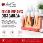 Dental Implants Cost Canada
