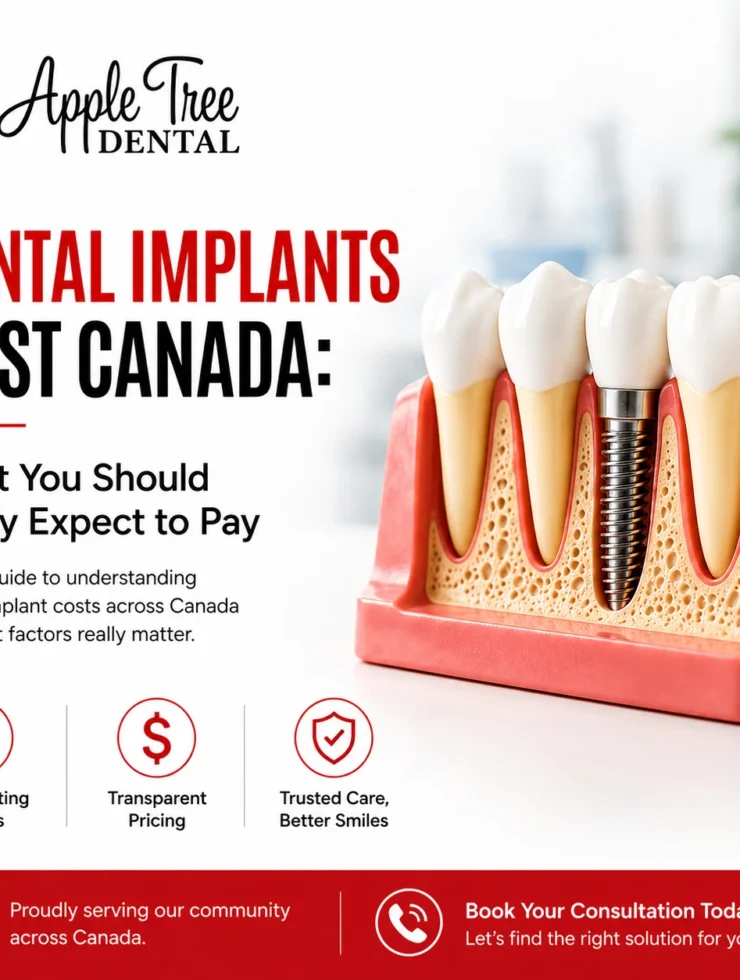 Dental Implants Cost Canada
