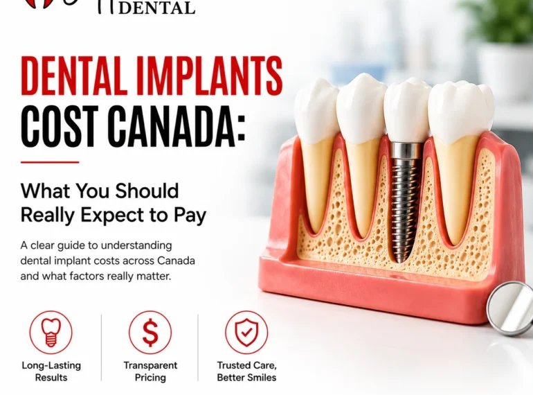 Dental Implants Cost Canada