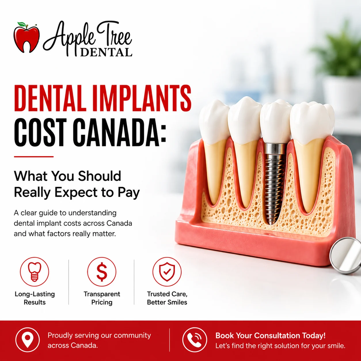 Dental Implants Cost Canada