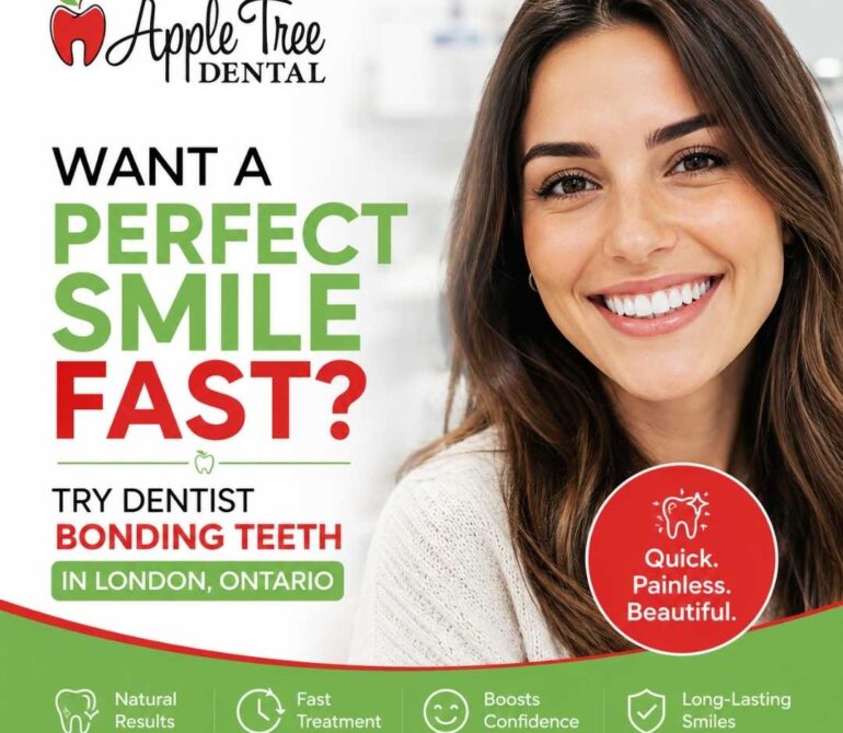 Want a Perfect Smile Fast Try Dentist Bonding Teeth in London, Ontario
