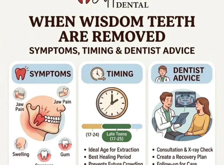 wisdom teeth are removed