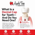 Dental Cap for teeth