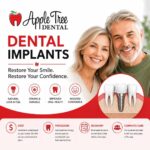 Dental Implants London ontario