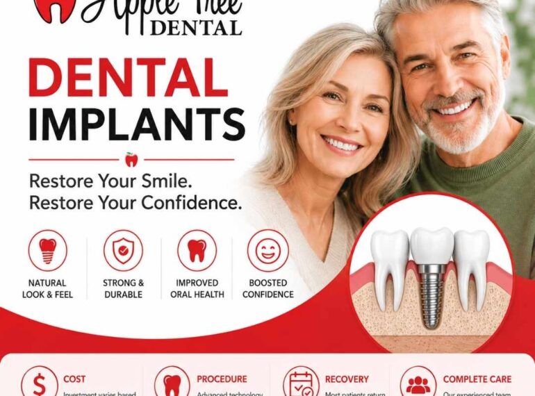 Dental Implants London ontario