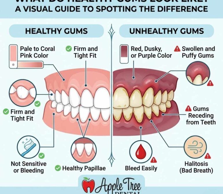 What Does Healthy Gums Look Like