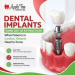 dental implants same day as extraction