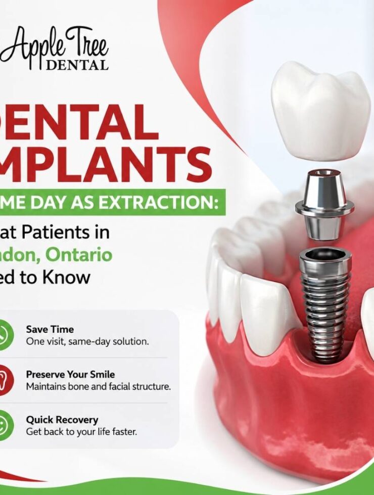dental implants same day as extraction