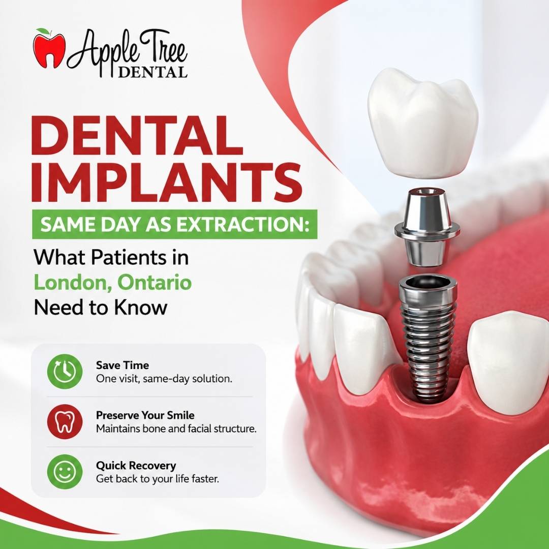 dental implants same day as extraction