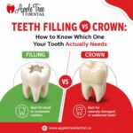 teeth filling vs crown