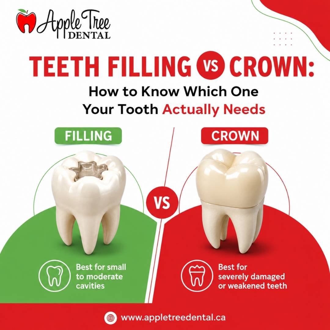 teeth filling vs crown