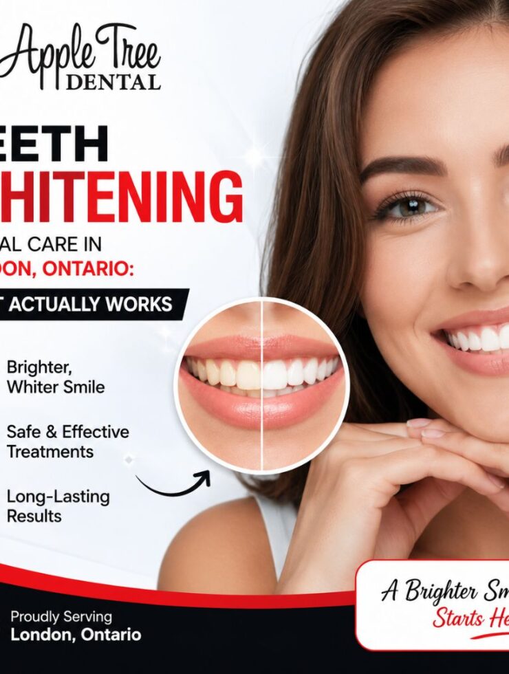 teeth whitening dental care