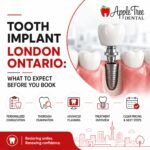 tooth implant london on
