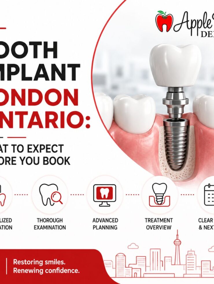 tooth implant london on