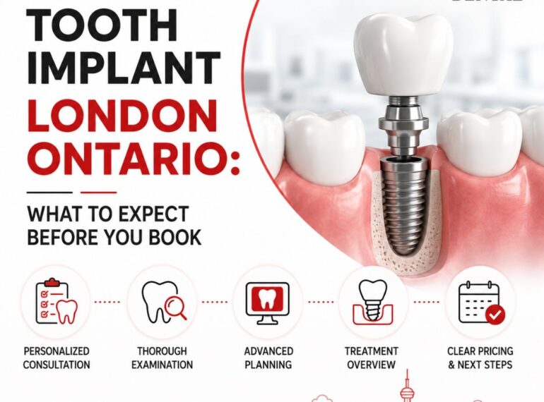 tooth implant london on