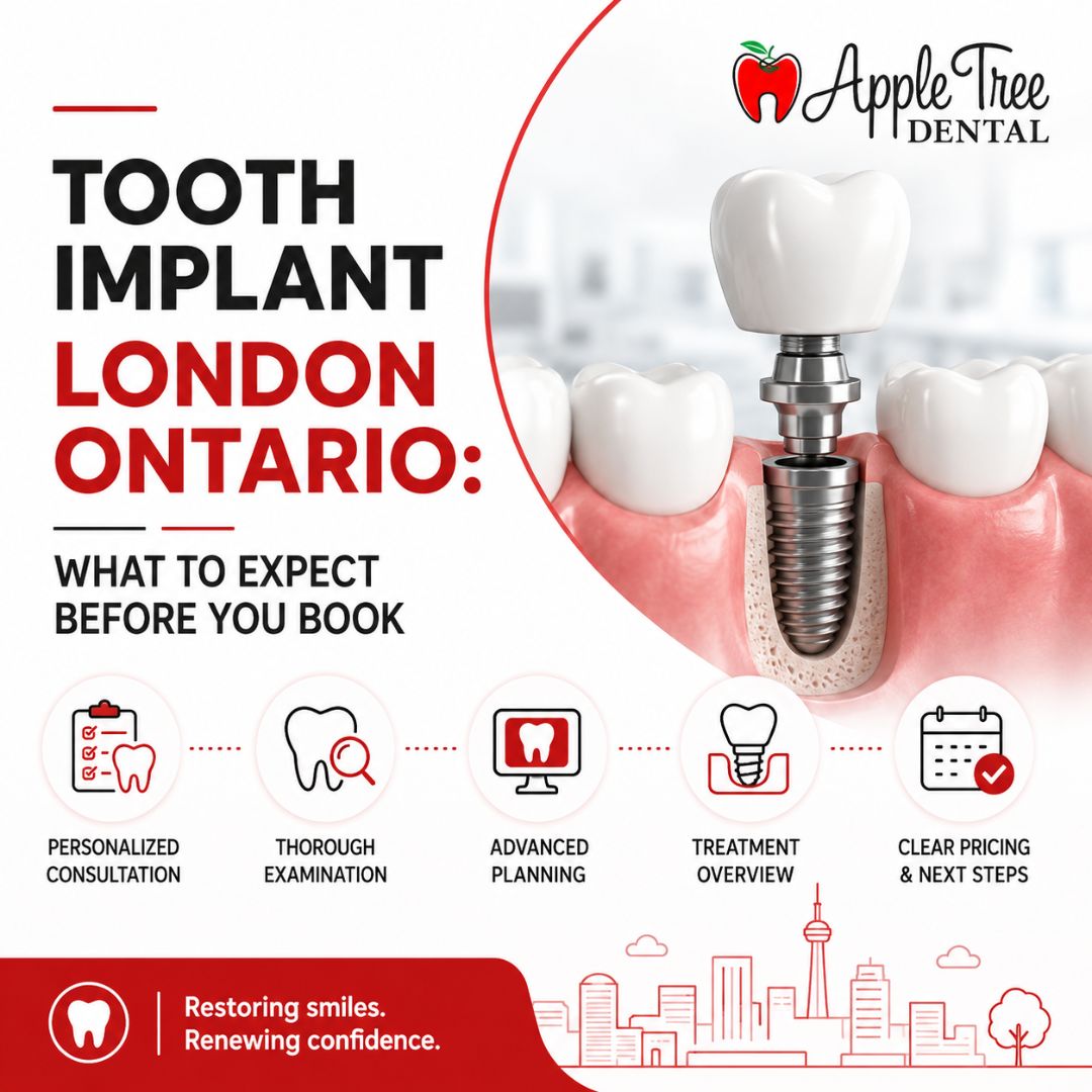 tooth implant london on