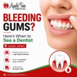 Bleeding Gums