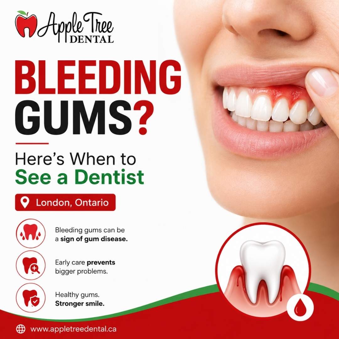 Bleeding Gums