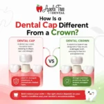 How Is a Dental Cap Different From a Crown