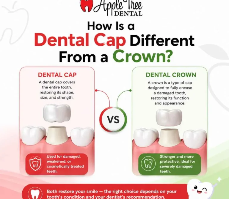 How Is a Dental Cap Different From a Crown