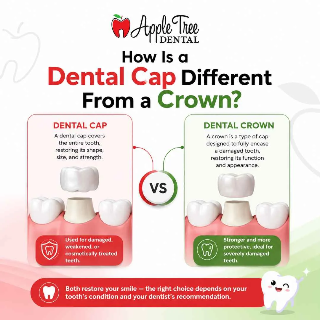 How Is a Dental Cap Different From a Crown