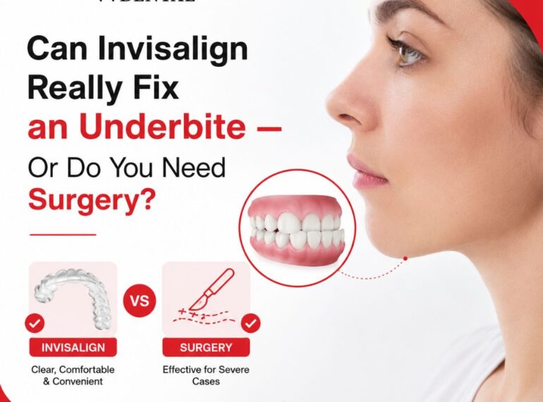 can invisalign fix underbite