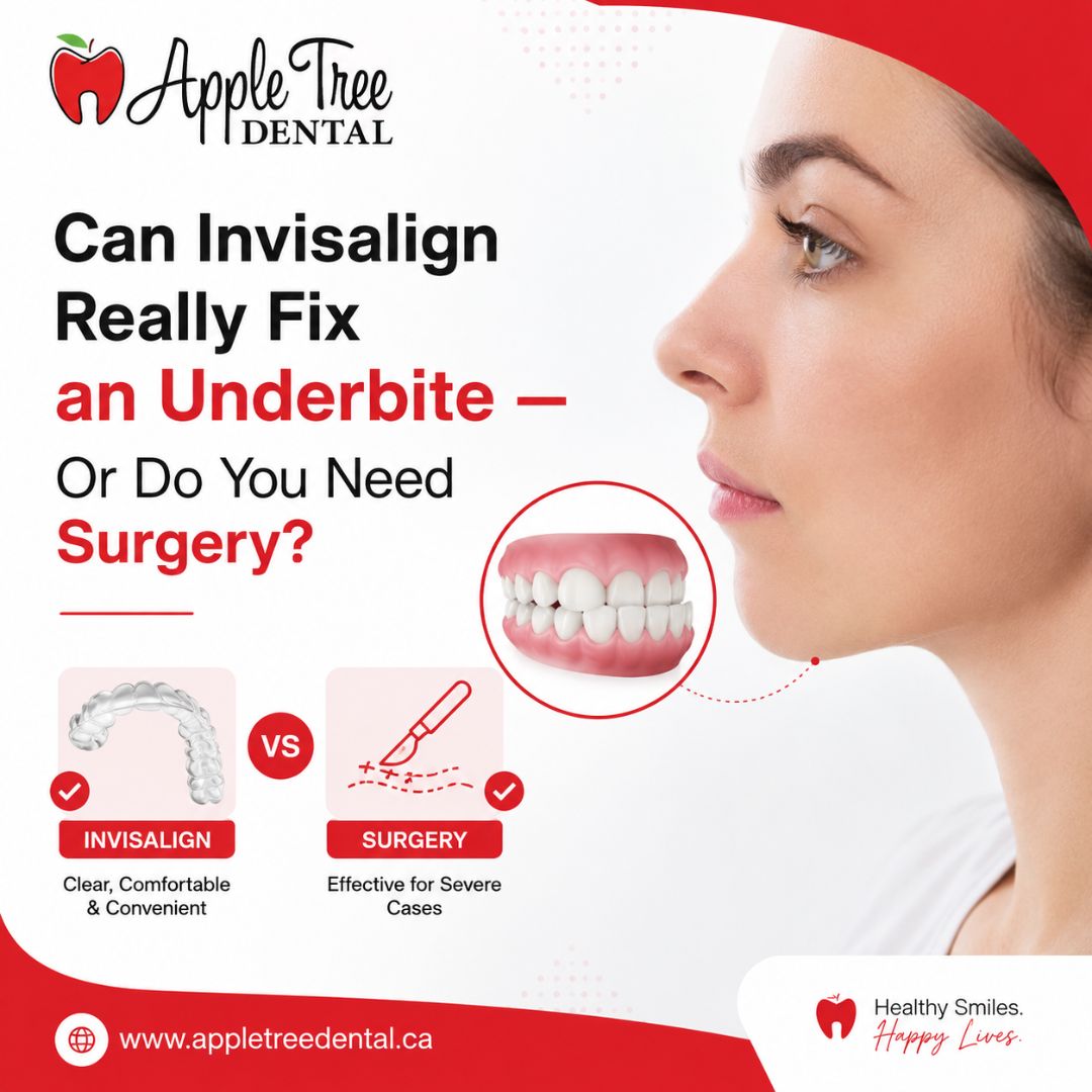 can invisalign fix underbite